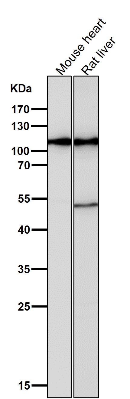 1 - Anti-Hexokinase 1 HK1 Rabbit Monoclonal Antibody ABO14121