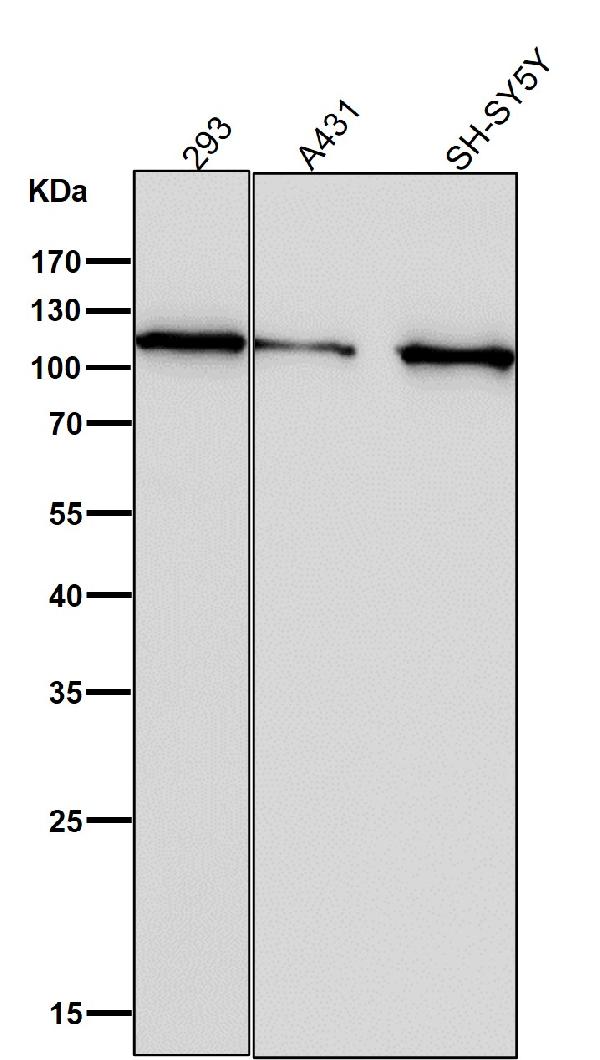 1 - Anti-Hexokinase 1 HK1 Rabbit Monoclonal Antibody ABO14121
