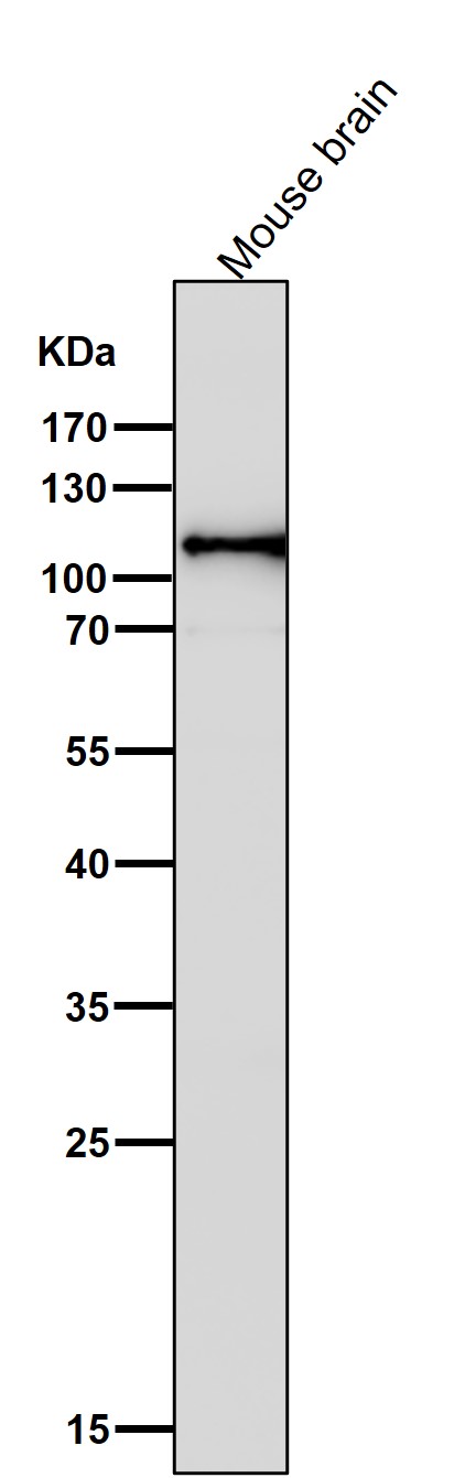 1 - Anti-Hexokinase 1 HK1 Rabbit Monoclonal Antibody ABO14121