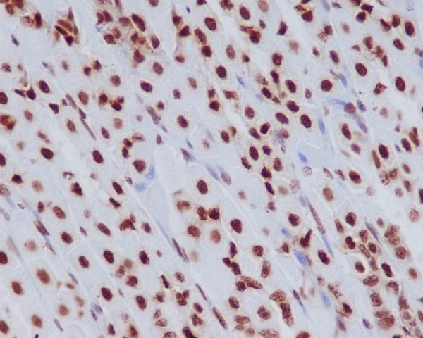 2 - Anti-Histone H3.3 H3F3A Rabbit Monoclonal Antibody ABO14122