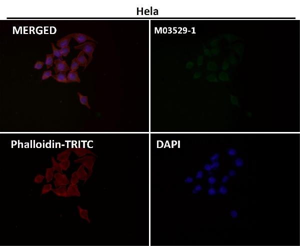 1 - Anti-Cytochrome C CYCS Rabbit Monoclonal Antibody ABO14123