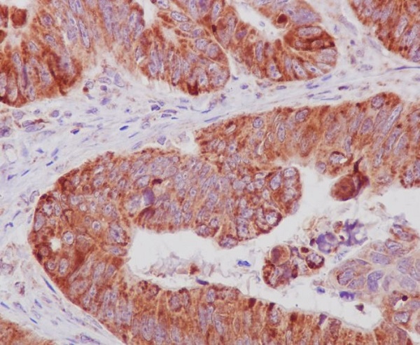 2 - Anti-Cytochrome C CYCS Rabbit Monoclonal Antibody ABO14123