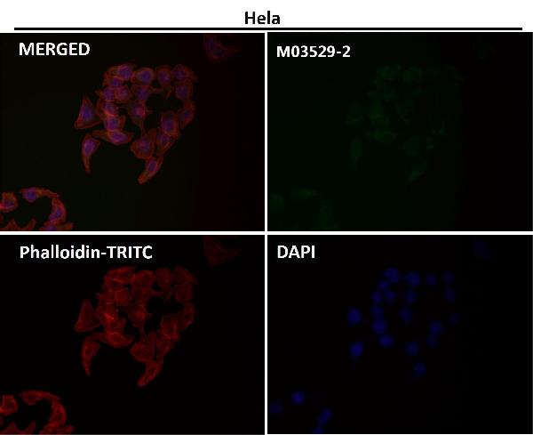 1 - Anti-Cytochrome C CYCS Rabbit Monoclonal Antibody ABO14124