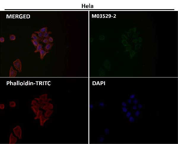 1 - Anti-Cytochrome C CYCS Rabbit Monoclonal Antibody ABO14124