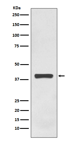 1 - Anti-AMPK gamma 1 Rabbit Monoclonal Antibody ABO14125