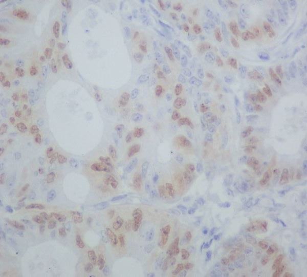 2 - Anti-Cyclin A1/A2 Rabbit Monoclonal Antibody ABO14126