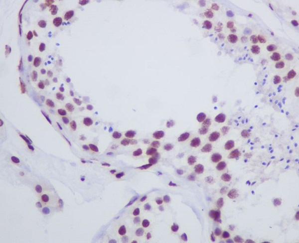 2 - Anti-Histone H1.0 H1F0 Rabbit Monoclonal Antibody ABO14127
