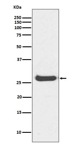 1 - Anti-Histone H1.0 H1F0 Rabbit Monoclonal Antibody ABO14127