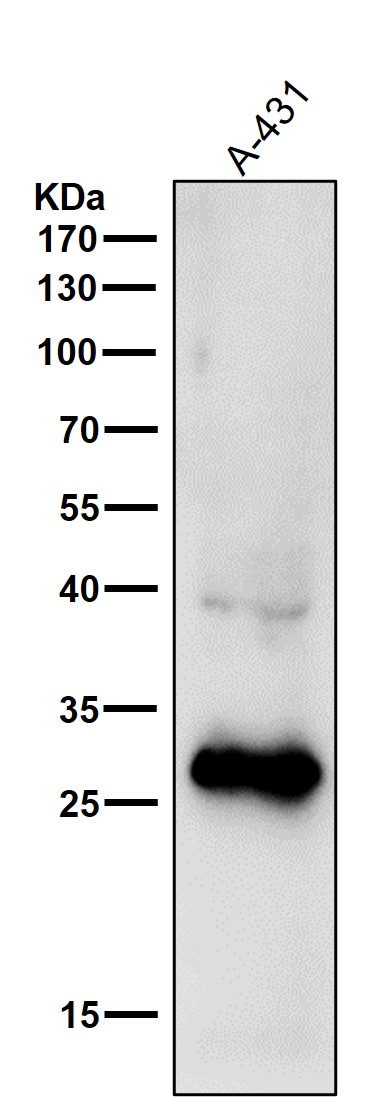 1 - Anti-14-3-3 sigma SFN Rabbit Monoclonal Antibody ABO14129