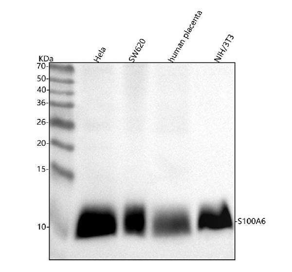 1 - Anti-S100 alpha 6 S100A6 Rabbit Monoclonal Antibody ABO14131