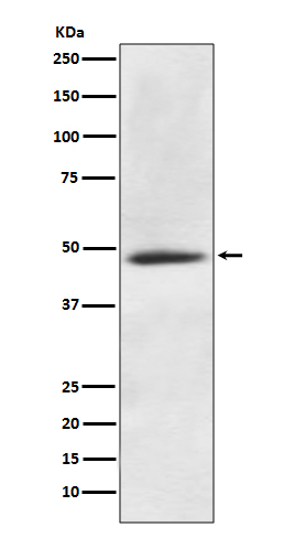 1 - Anti-CaMKII alpha CAMK2A Rabbit Monoclonal Antibody ABO14133