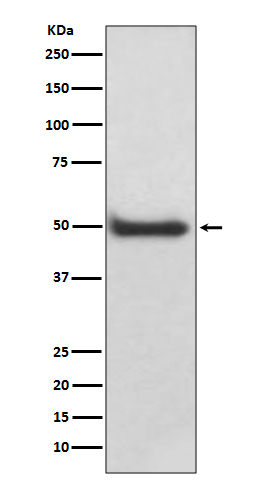 1 - Anti-CaMKII delta CAMK2D Rabbit Monoclonal Antibody ABO14134