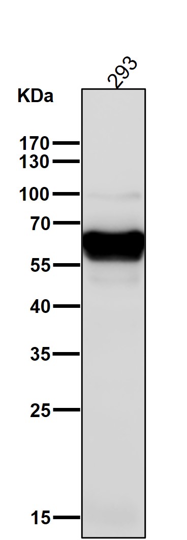 1 - Anti-CaMKII delta CAMK2D Rabbit Monoclonal Antibody ABO14134
