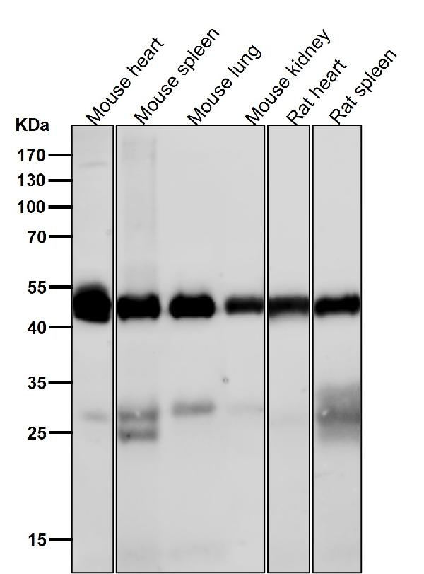 1 - Anti-CaMKII delta CAMK2D Rabbit Monoclonal Antibody ABO14134