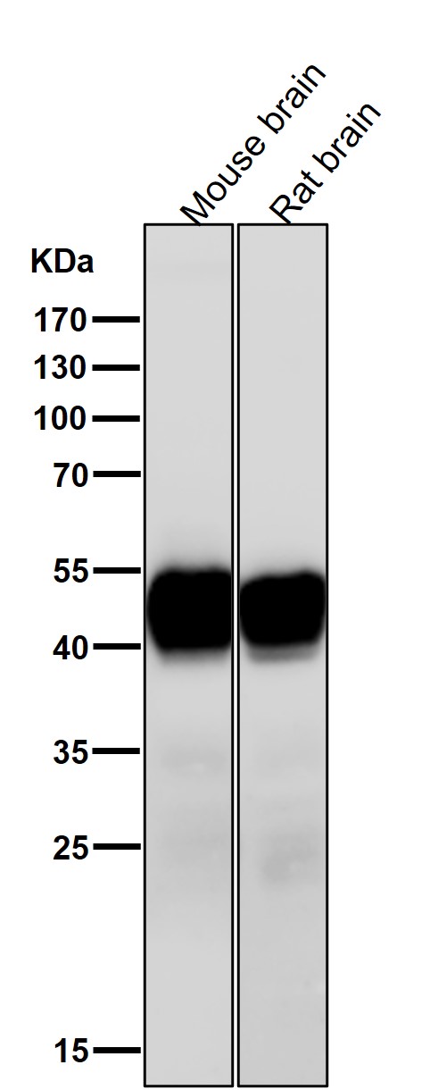 1 - Anti-CaMKII delta CAMK2D Rabbit Monoclonal Antibody ABO14134