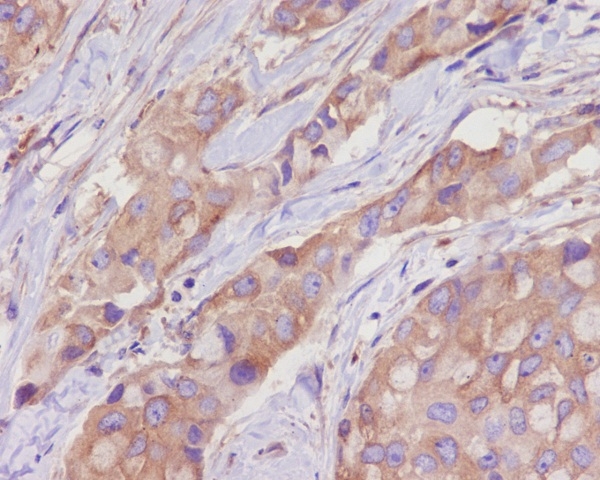 2 - Anti-alpha Tubulin TUBA1B Rabbit Monoclonal Antibody ABO14136