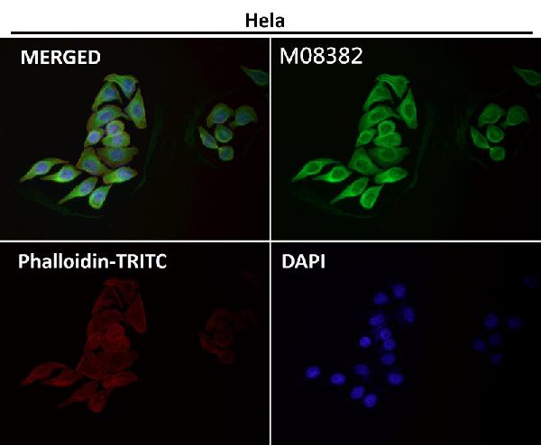 1 - Anti-alpha Tubulin TUBA1B Rabbit Monoclonal Antibody ABO14136