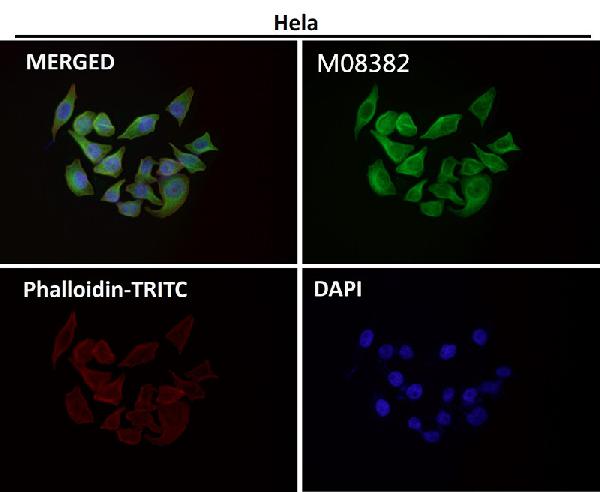 1 - Anti-alpha Tubulin TUBA1B Rabbit Monoclonal Antibody ABO14136
