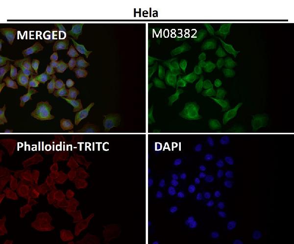 1 - Anti-alpha Tubulin TUBA1B Rabbit Monoclonal Antibody ABO14136