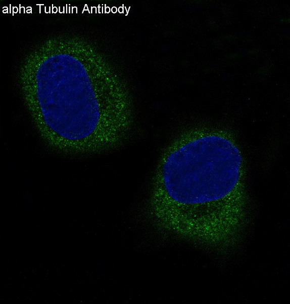3 - Anti-alpha Tubulin TUBA1B Rabbit Monoclonal Antibody ABO14136