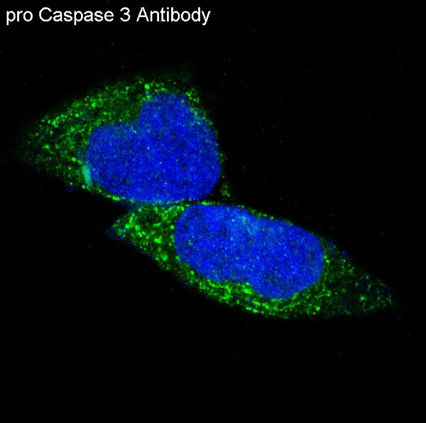 3 - Anti-pro Caspase 3 CASP3 Rabbit Monoclonal Antibody ABO14137