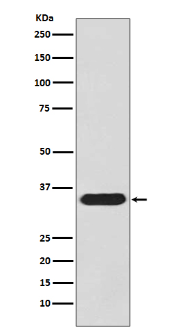 1 - Anti-pro Caspase 3 CASP3 Rabbit Monoclonal Antibody ABO14137