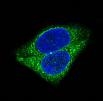 3 - Anti-Synaptophysin SYP Rabbit Monoclonal Antibody ABO14139