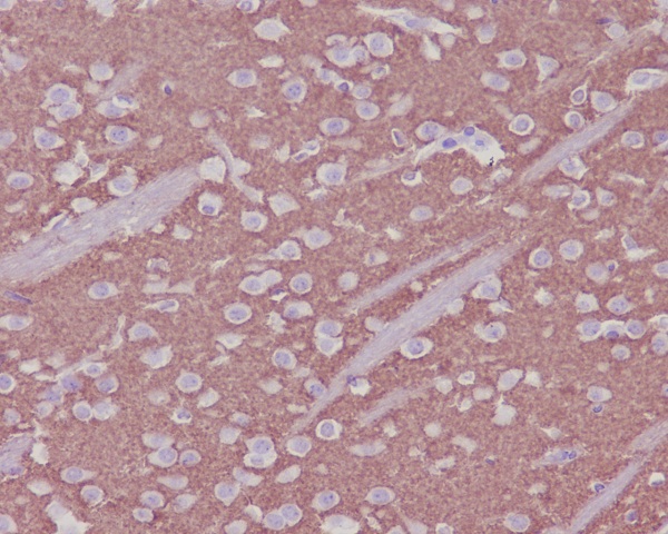 2 - Anti-Synaptophysin SYP Rabbit Monoclonal Antibody ABO14139