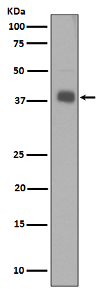 1 - Anti-Synaptophysin SYP Rabbit Monoclonal Antibody ABO14139