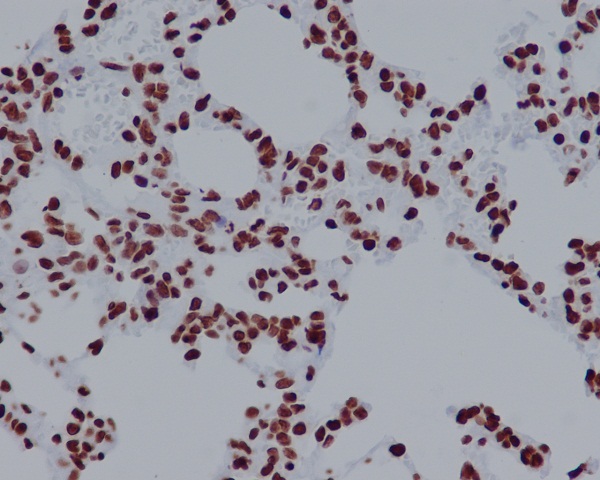 2 - Anti-Histone H2A.X H2AFX Rabbit Monoclonal Antibody ABO14140
