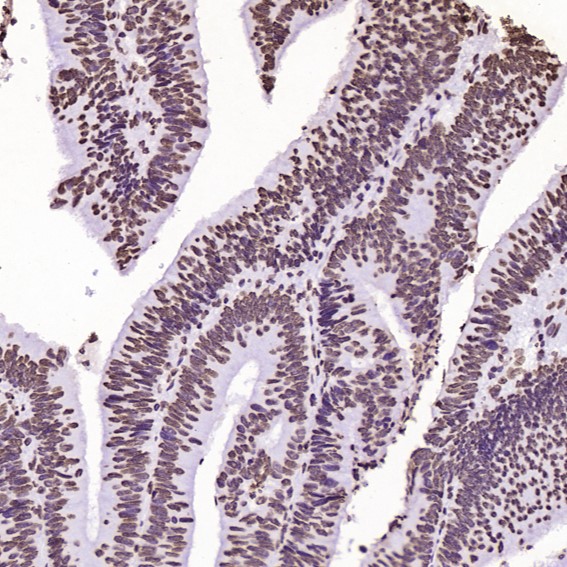 2 - Anti-Histone H2A.X H2AFX Rabbit Monoclonal Antibody ABO14140