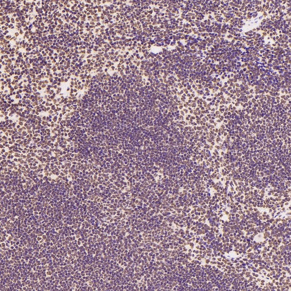 2 - Anti-Histone H2A.X H2AFX Rabbit Monoclonal Antibody ABO14140