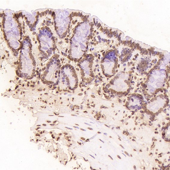 2 - Anti-Histone H2A.X H2AFX Rabbit Monoclonal Antibody ABO14140