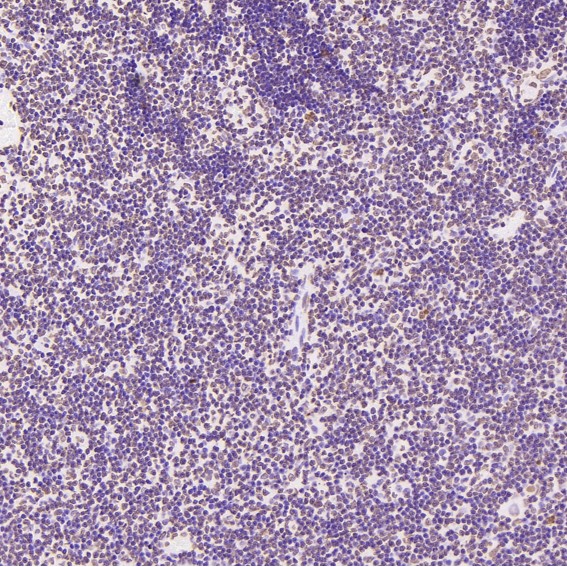 2 - Anti-Histone H2A.X H2AFX Rabbit Monoclonal Antibody ABO14140