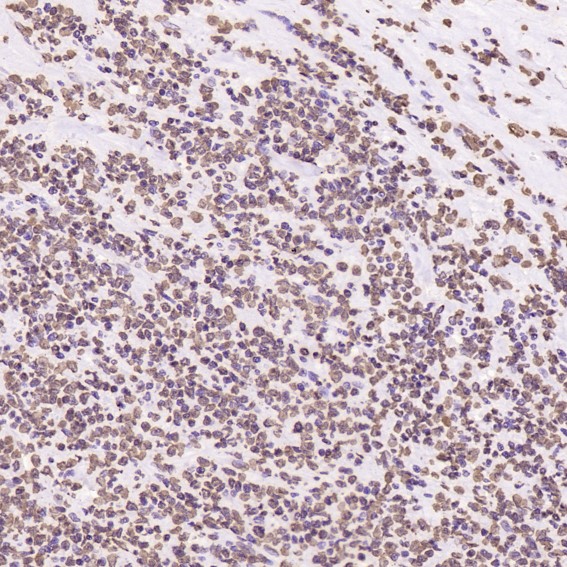 2 - Anti-Histone H2A.X H2AFX Rabbit Monoclonal Antibody ABO14140