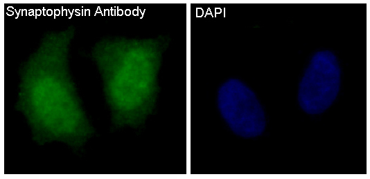 3 - Anti-Synaptophysin SYP Rabbit Monoclonal Antibody ABO14141