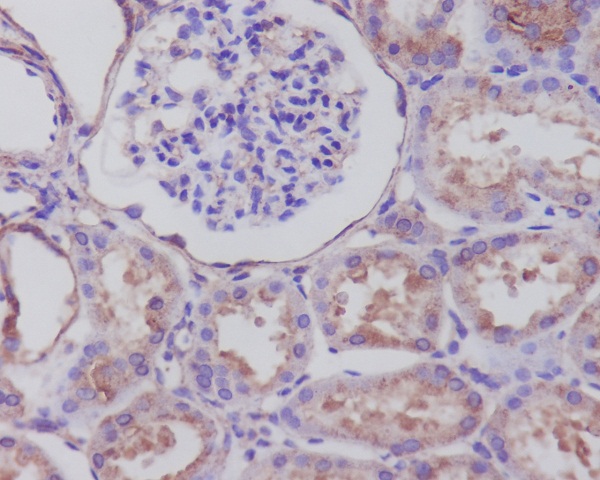 2 - Anti-Synaptophysin SYP Rabbit Monoclonal Antibody ABO14141