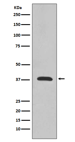 1 - Anti-Synaptophysin SYP Rabbit Monoclonal Antibody ABO14141