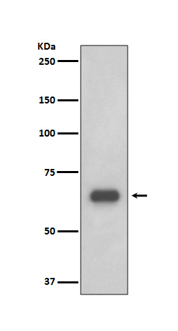 1 - Anti-p70 S6 Kinase RPS6KB1 Rabbit Monoclonal Antibody ABO14142