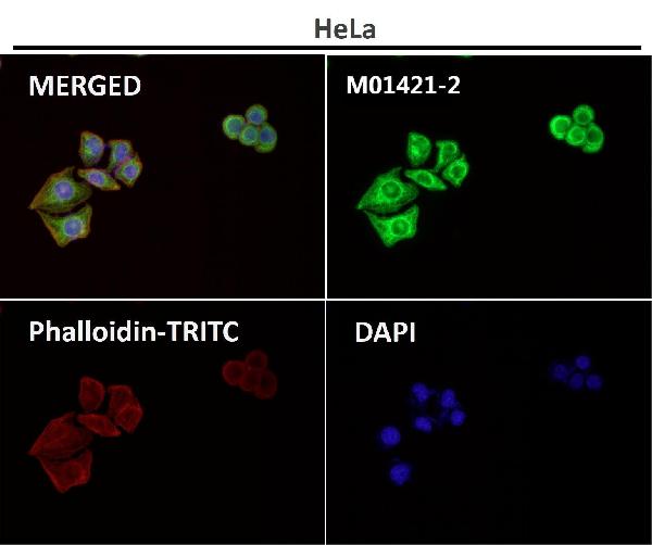 1 - Anti-Cytokeratin 8 KRT8 Rabbit Monoclonal Antibody ABO14143