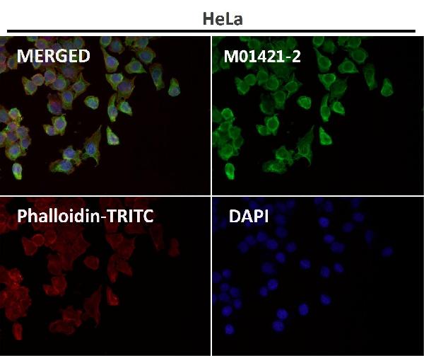 1 - Anti-Cytokeratin 8 KRT8 Rabbit Monoclonal Antibody ABO14143