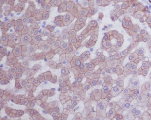 2 - Anti-Cytokeratin 8 KRT8 Rabbit Monoclonal Antibody ABO14143