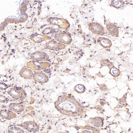 2 - Anti-Cytokeratin 8 KRT8 Rabbit Monoclonal Antibody ABO14143