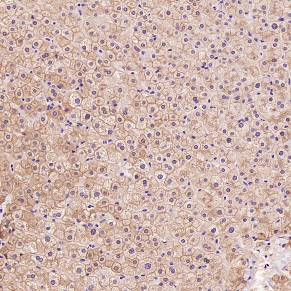 2 - Anti-Cytokeratin 8 KRT8 Rabbit Monoclonal Antibody ABO14143