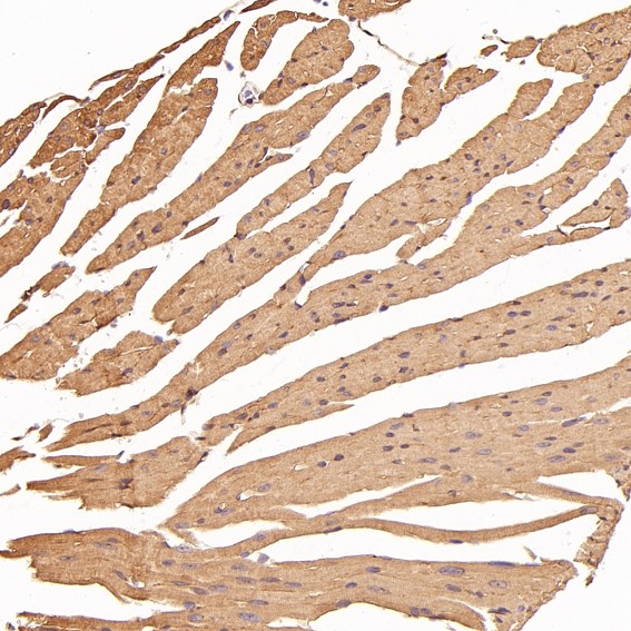 2 - Anti-Cytokeratin 8 KRT8 Rabbit Monoclonal Antibody ABO14143