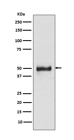 1 - Anti-Cytokeratin 8 KRT8 Rabbit Monoclonal Antibody ABO14143