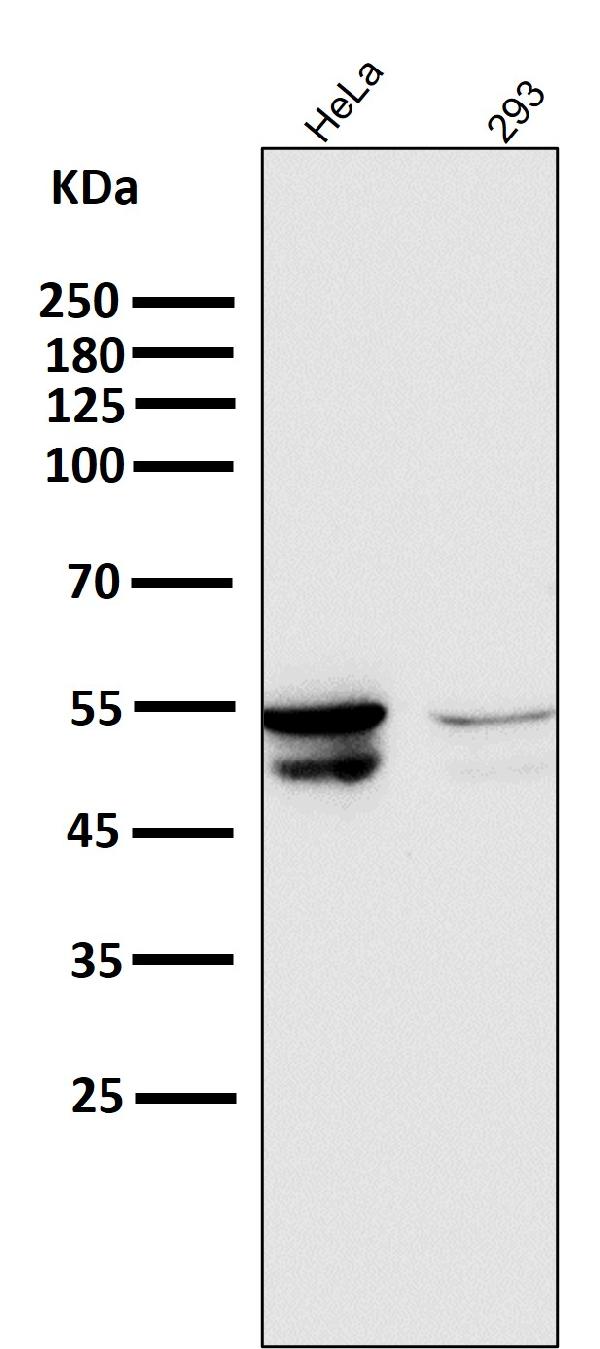 1 - Anti-Cytokeratin 8 KRT8 Rabbit Monoclonal Antibody ABO14143