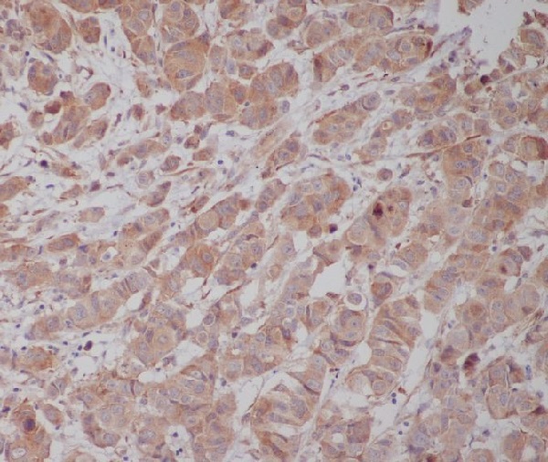 2 - Anti-Tubulin gamma Rabbit Monoclonal Antibody ABO14145
