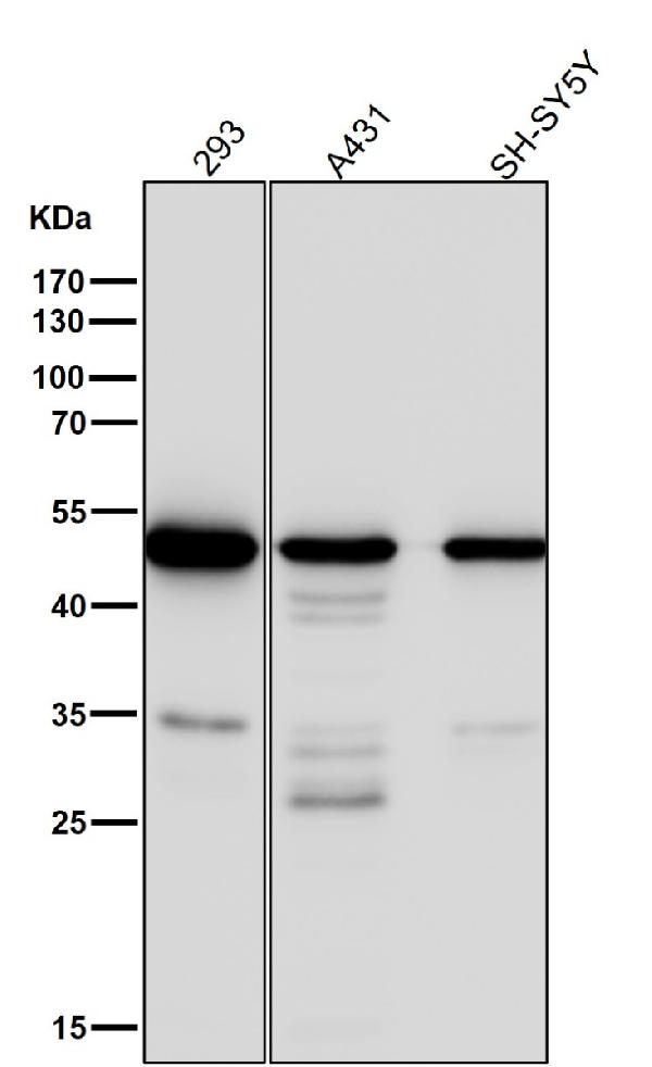 1 - Anti-Tubulin gamma Rabbit Monoclonal Antibody ABO14145