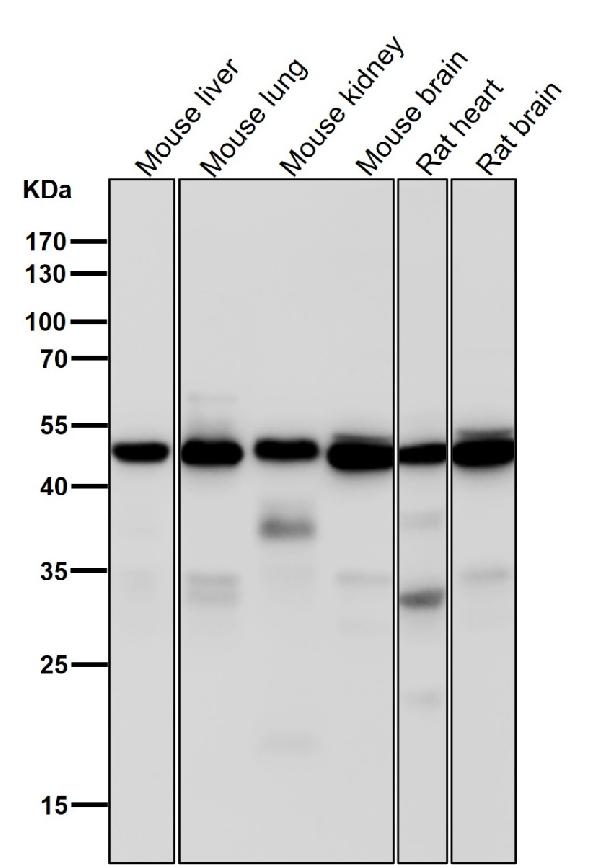 1 - Anti-Tubulin gamma Rabbit Monoclonal Antibody ABO14145